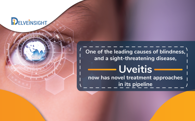 Uveitis-market