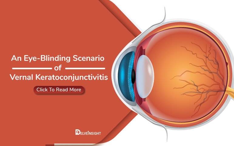 Vernal-keratoconjunctivitis-VKC-Market-Size-and-Share