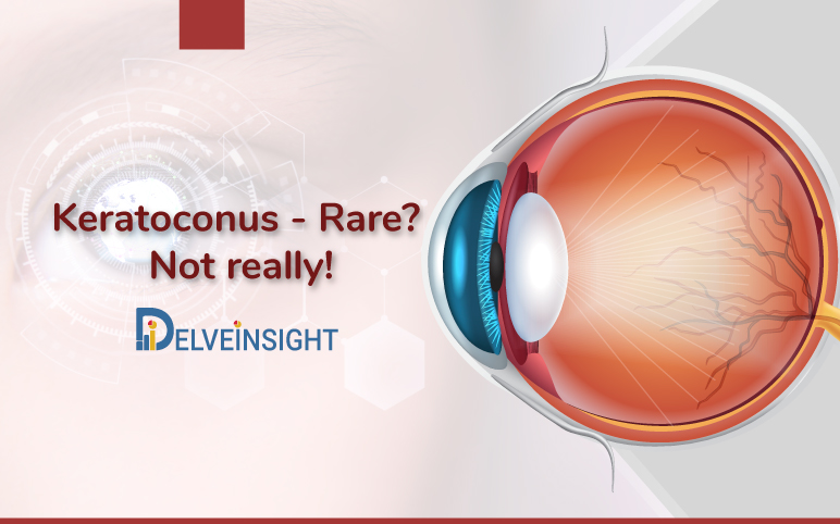 Keratoconus Market