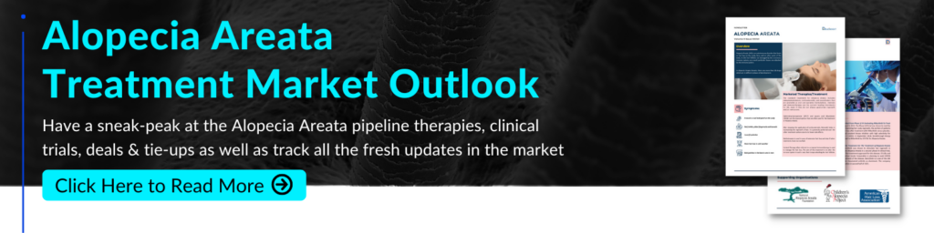 Alopecia Areata Treatment Market