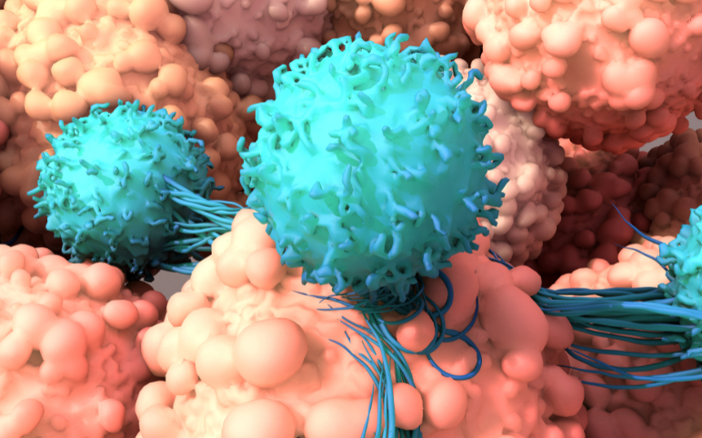 Cutaneous T-cell Lymphoma Treatment Outlook