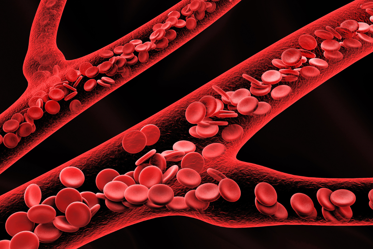 Golcadomide-Rituximab Combo in DLBCL Patient