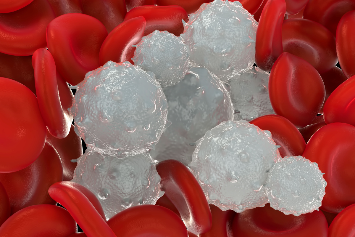 ascvd-treatment-beyond-statin