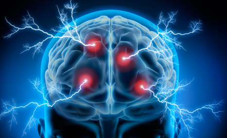 wireless-brain-sensors-in-healthcare