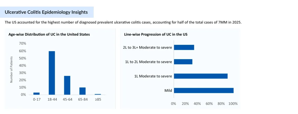 ulcerative-colitis-epidemiology-assessment