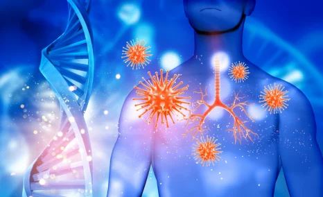 burden-of-systemic-lupus-erythematosus