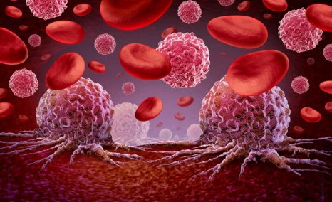 tudriqev-approval-for-melanoma