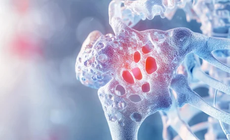 emerging-therapies-for-osteosarcoma-treatment