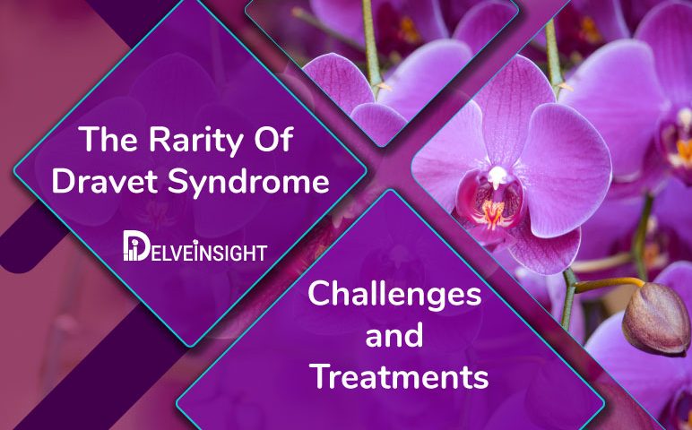 The Rarity Of Dravet Syndrome: Challenges, and Treatments