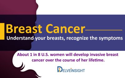 Breast Cancer: Understand your breasts, recognize the symptoms