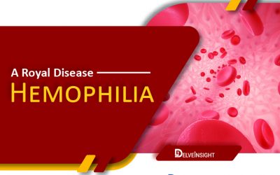 A Royal Disease: Hemophilia