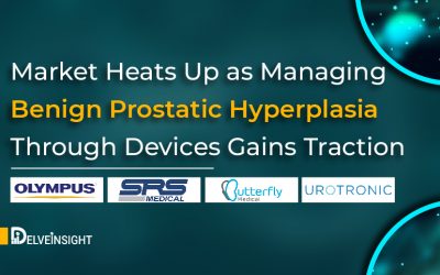 Market Heats Up as Managing Benign Prostatic Hyperplasia Through...
