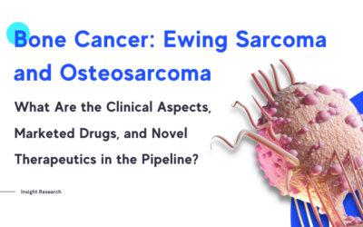 Osteosarcoma vs Ewing sarcoma