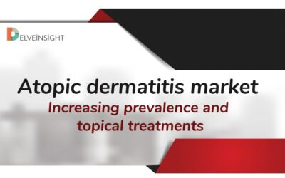 Atopic dermatitis market: Increasing prevalence and topical treat...